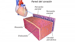 Pericardite Crônica